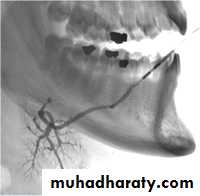 Salivary glands