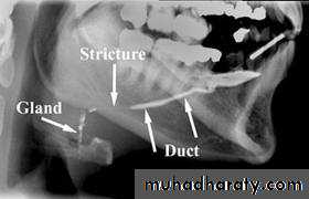 Salivary glands
