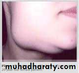 Salivary glands