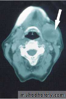 Salivary glands