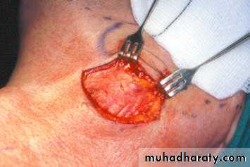 Salivary glands