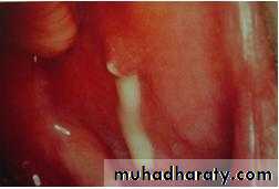 Salivary glands