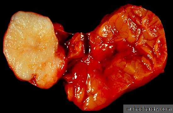 Salivary glands