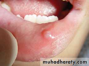 Salivary glands