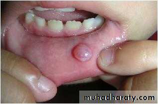 Salivary glands