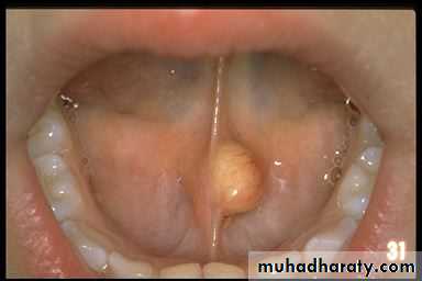 Salivary glands