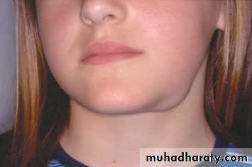 Salivary glands