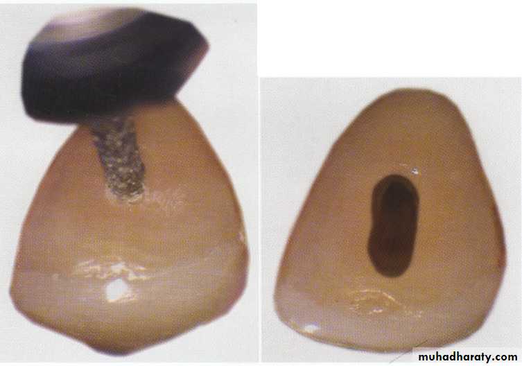 Endodontics