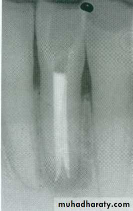 Endodontics