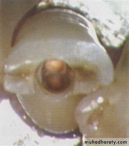 Endodontics