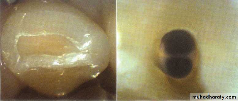 Endodontics