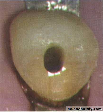 Endodontics
