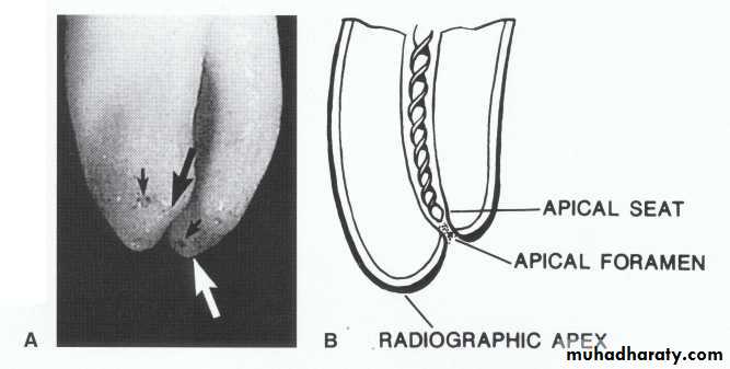 Endodontics