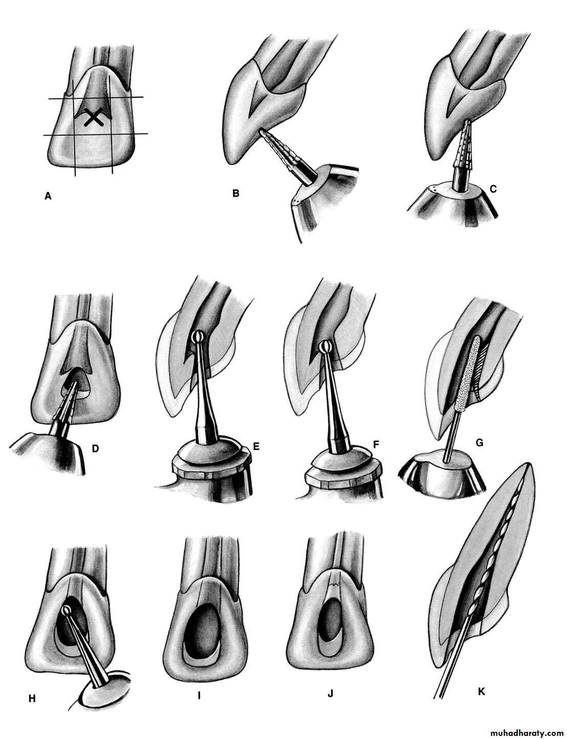 Endodontics