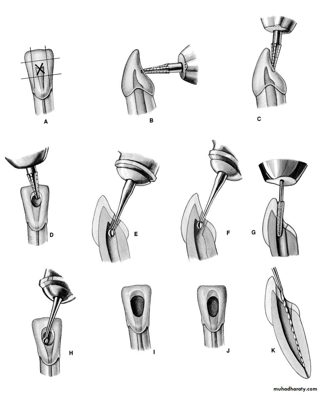 Endodontics