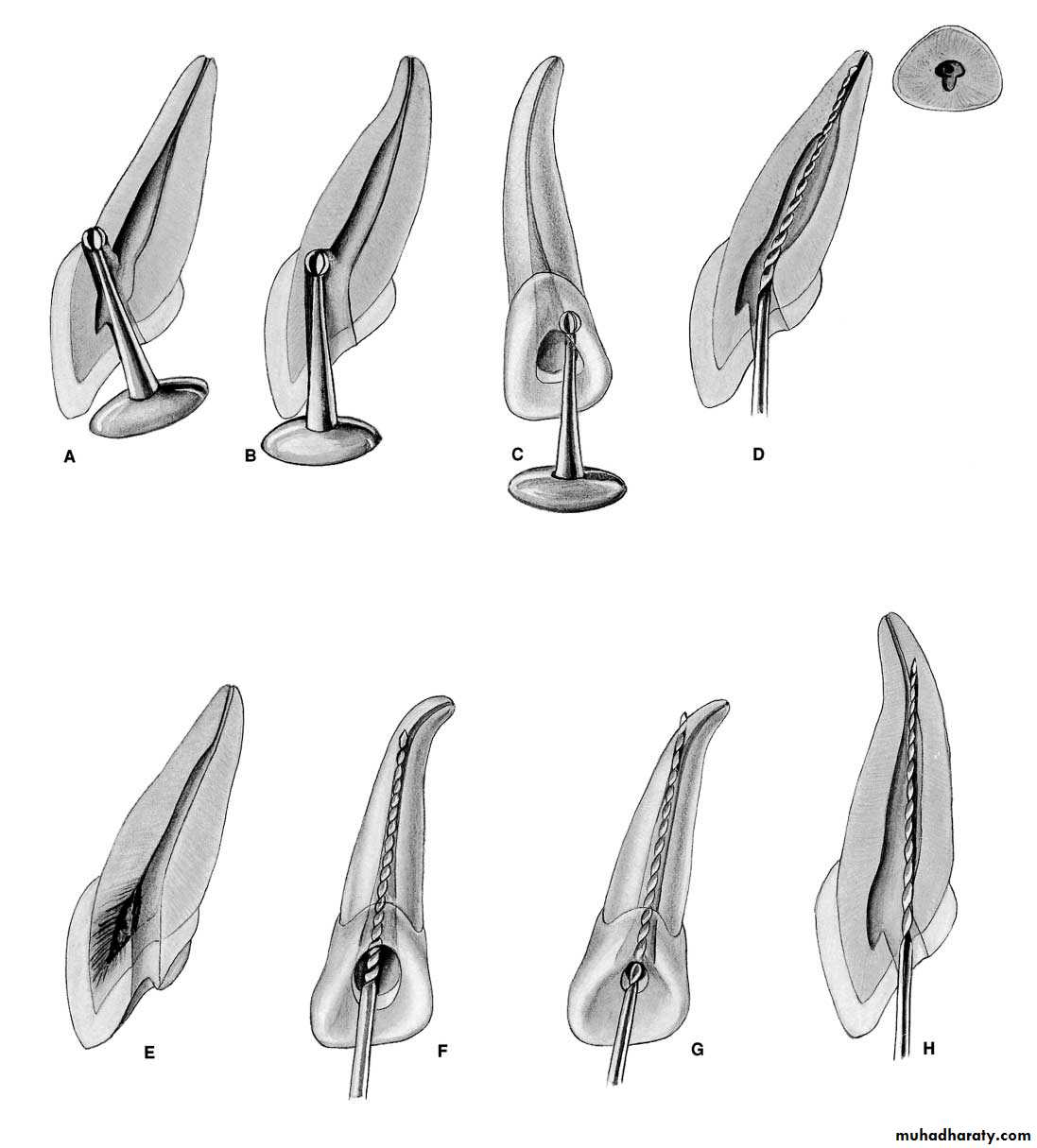 Endodontics