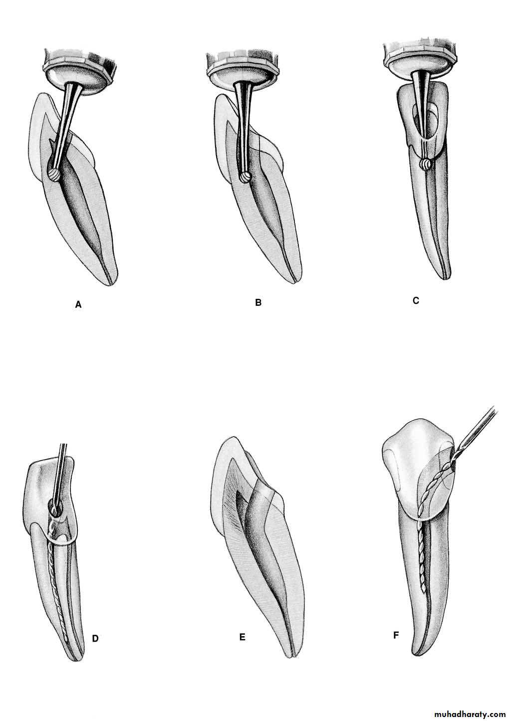 Endodontics