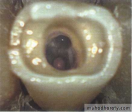 Endodontics