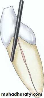 Endodontics