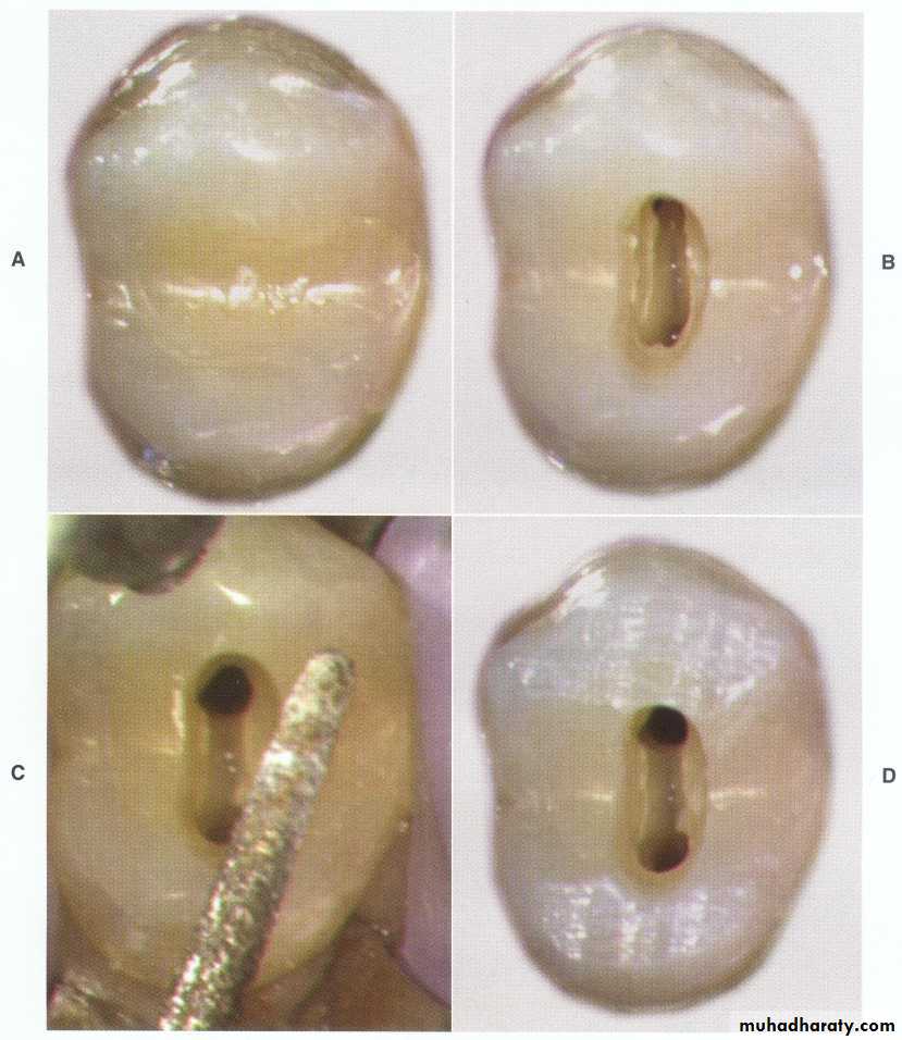 Endodontics
