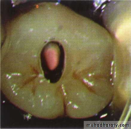 Endodontics