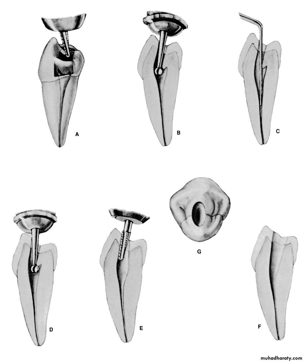Endodontics