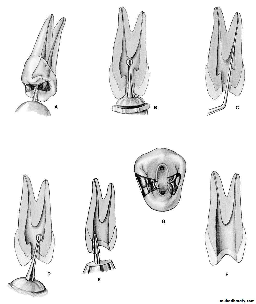 Endodontics