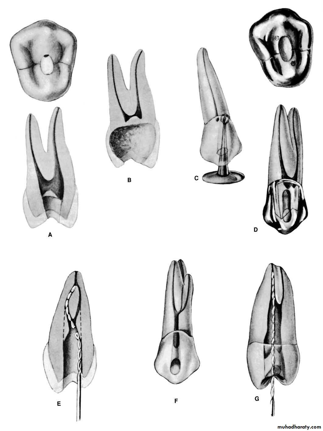 Endodontics