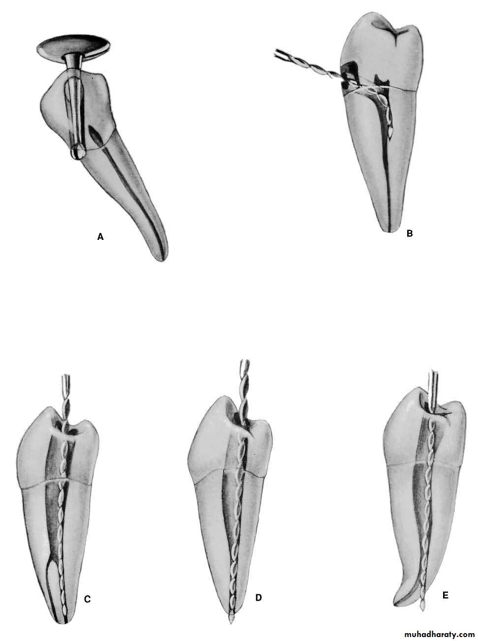Endodontics