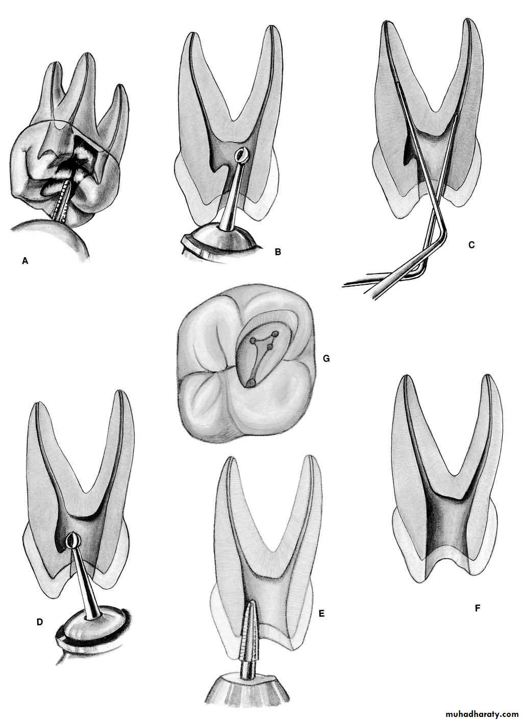 Endodontics