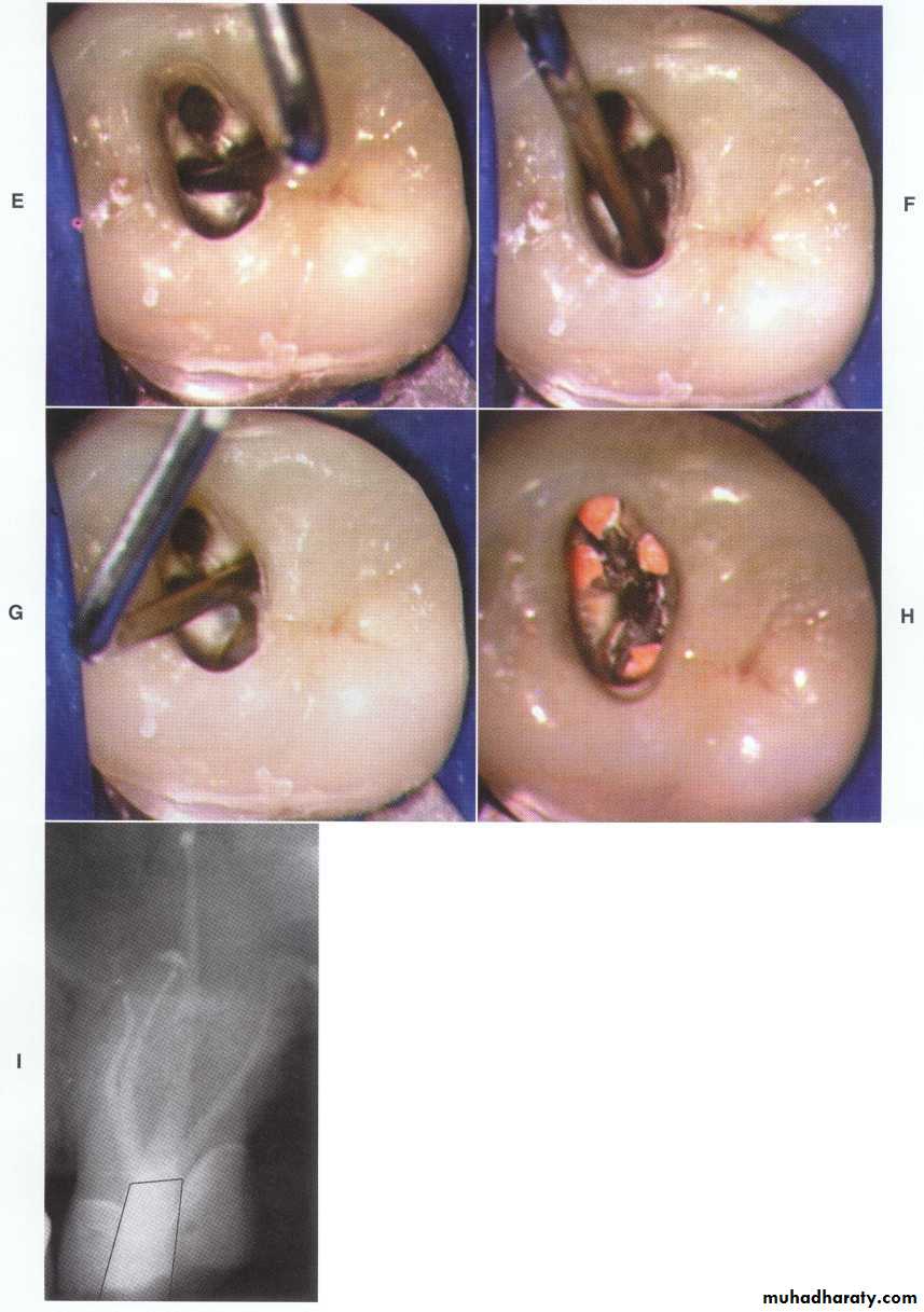 Endodontics