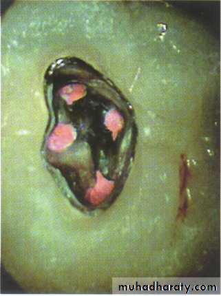 Endodontics