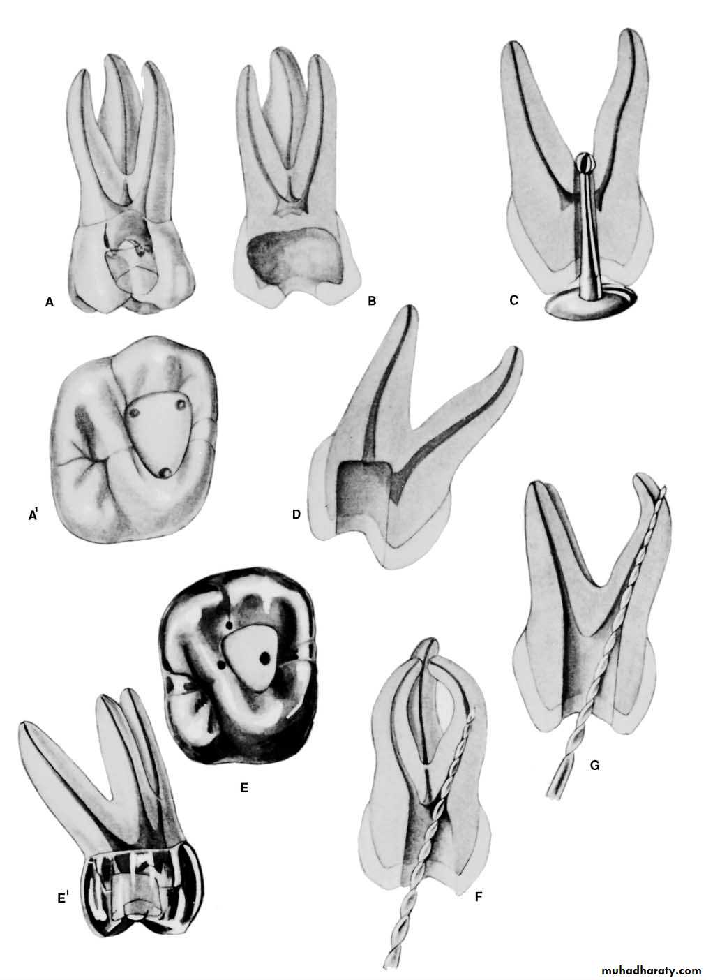 Endodontics