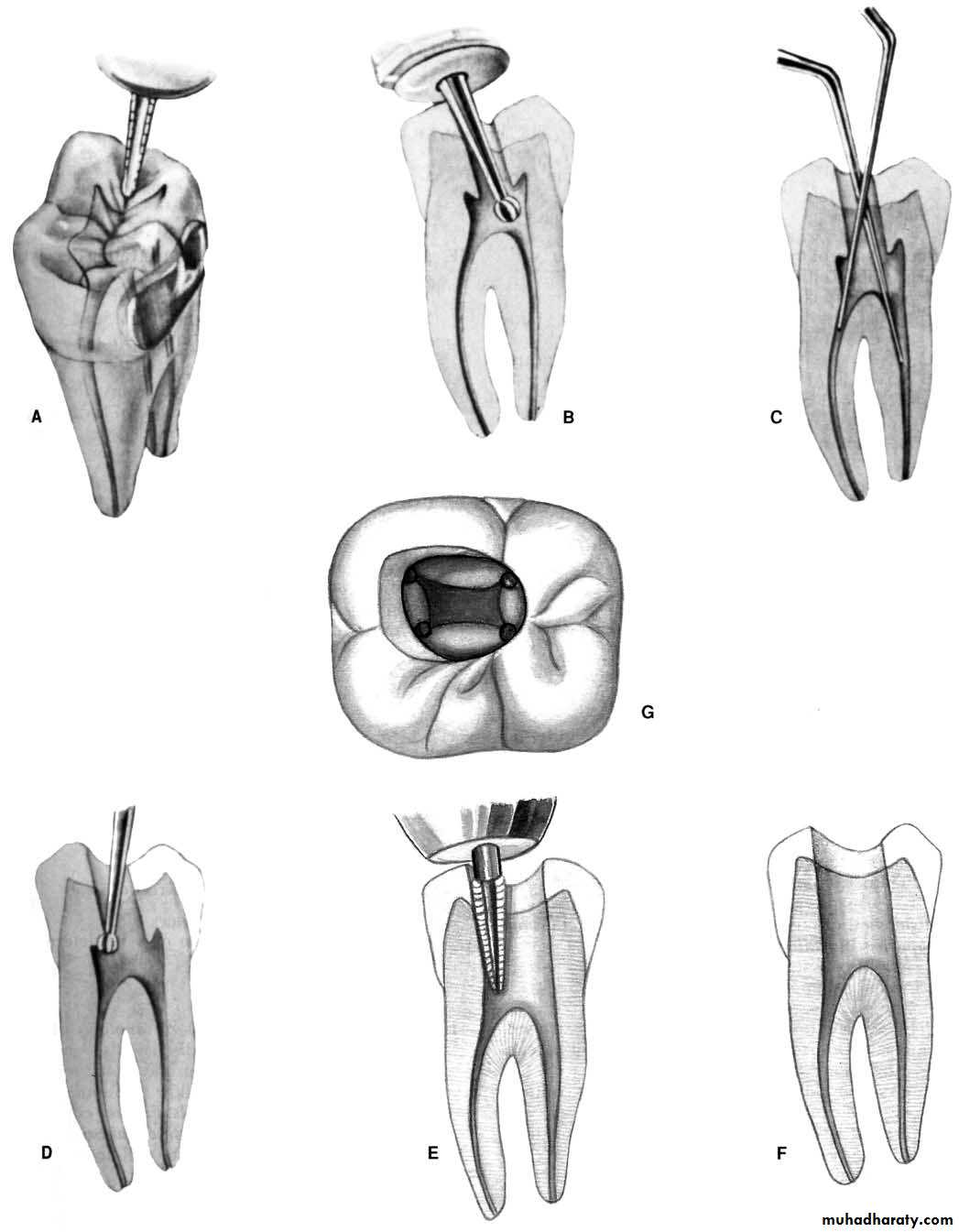 Endodontics