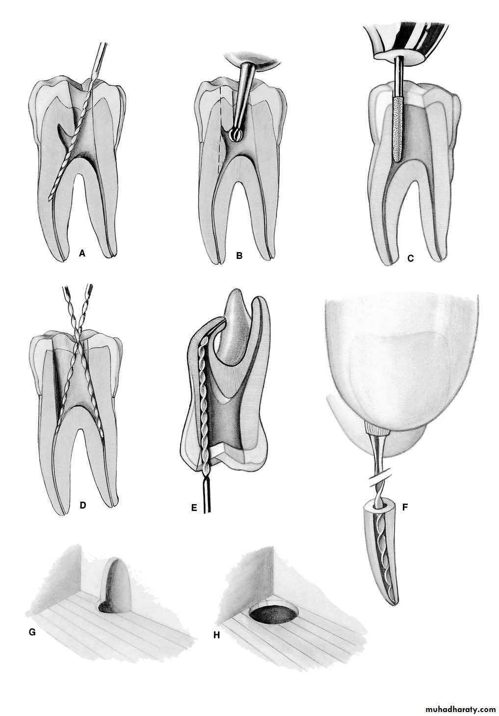 Endodontics