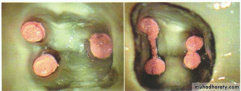 Endodontics