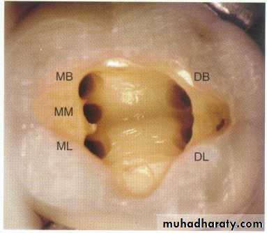 Endodontics