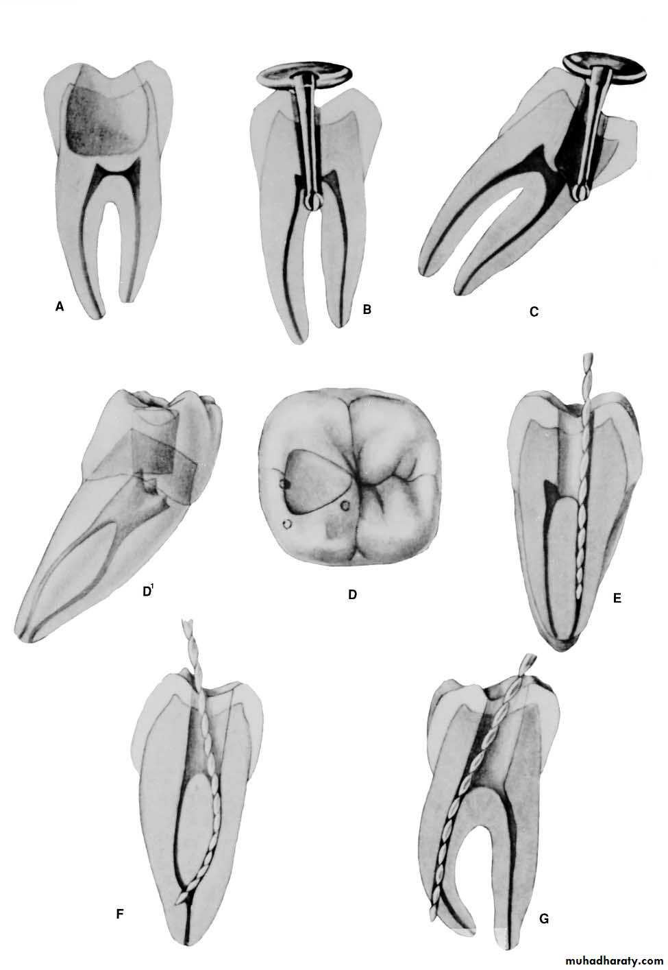 Endodontics