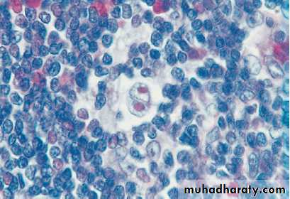 Hematology