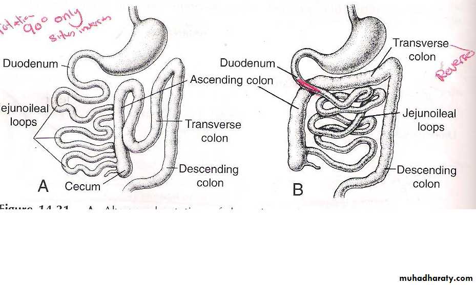 Mid Gut