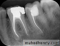 Endodontics