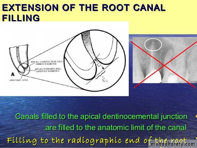 Endodontics