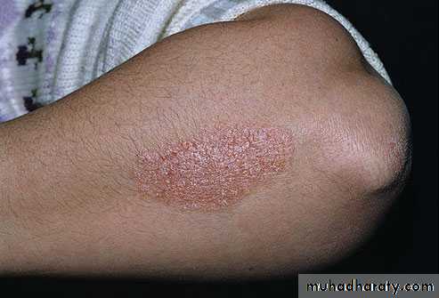 Dermatology sessions