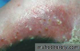 Dermatology sessions