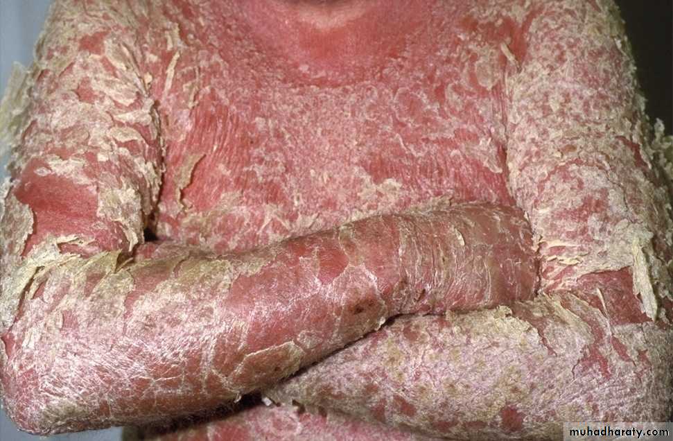 Dermatology sessions