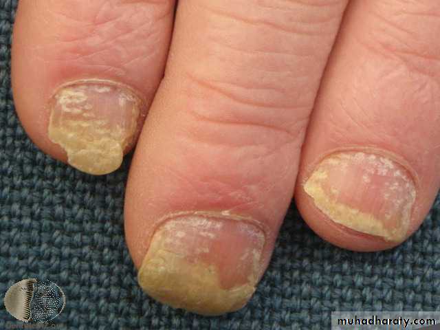 Dermatology sessions