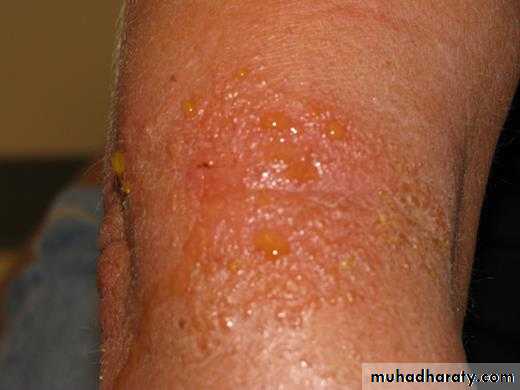 Dermatology sessions
