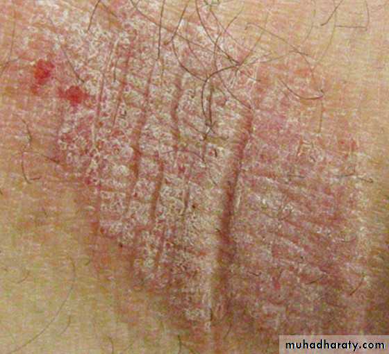 Dermatology sessions