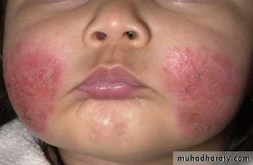 Dermatology sessions
