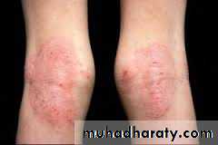 Dermatology sessions